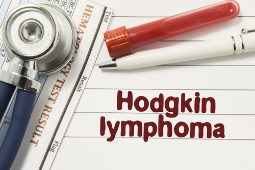 early-signs-and-symptoms-of-hodgkin-s-lymphoma